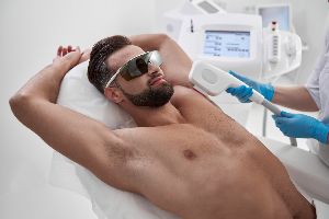 laser hair removal