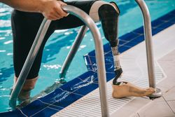 3 Factors to Consider When Choosing a Prosthesis - National Prosthetics ...