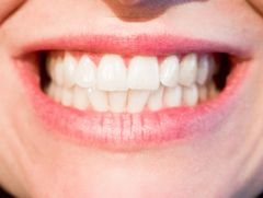 teeth-whitening-Kaimuki-Dental-Group-HI