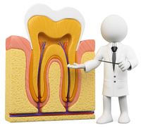 root canal 