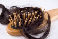 women's-hair-loss-hair-restoration