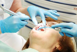 tooth extraction