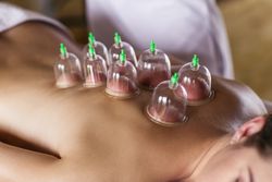 cupping therapy Nyack NY
