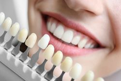 teeth whitening treatments Lexington KY