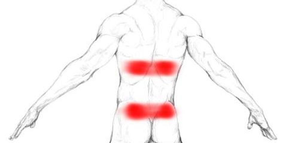 Back Pain Caused by Abdominal Trigger Points - Trigger Point Myotherapy