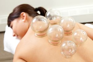 cupping therapy