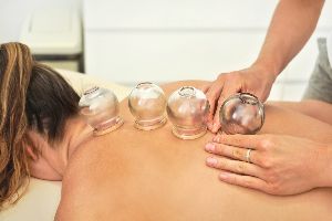 cupping therapy