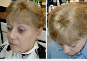 scalp treatments