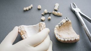 dental crowns 