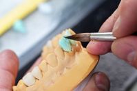 When Do You Need Dental Bridge Repair