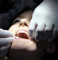 dental implants anchorage