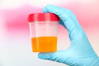 urinalysis-for-drug-testing